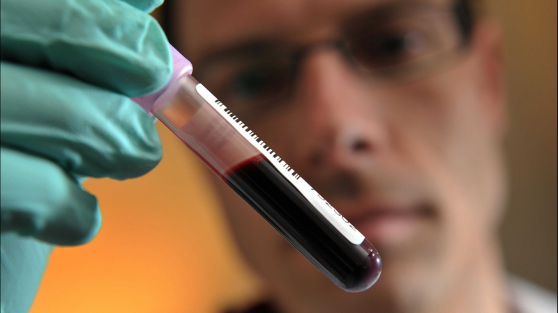 WADA have tested 'around 3000' Russian athletes