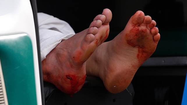 The blood stained feet of a man hang outside an ambulance outside a medical tent located near the finish after the bombs exploded