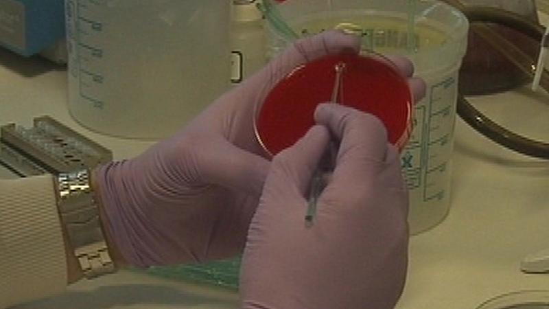 Main symptoms in children are a rash, high temperature and irritability