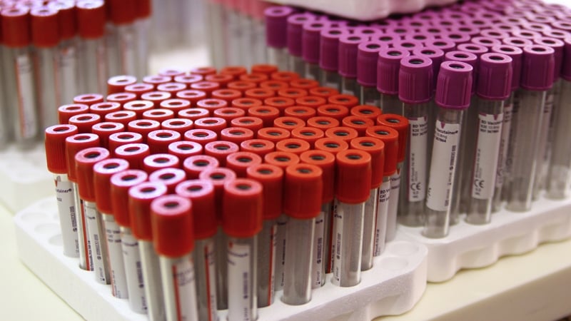 More than 260 people with haemophilia were infected with the virus from contaminated blood products