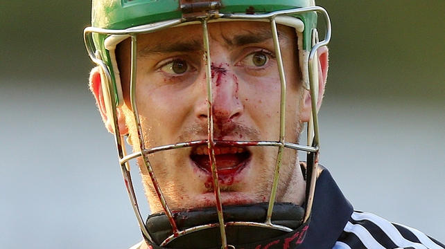 Dublin's Ryan O'Dwyer shows the wounds of battle from their draw with Wexford in the Leinster SHC quarter-final