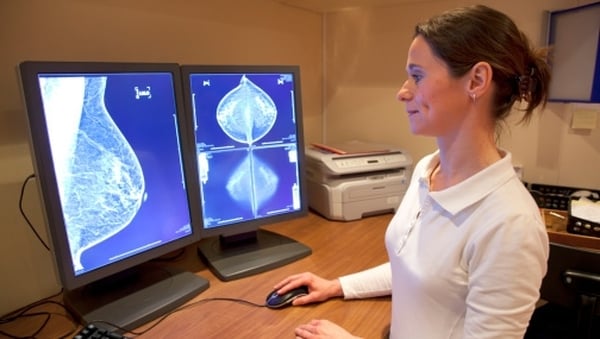IMO issues warning to medical card patients over breast cancer treatment