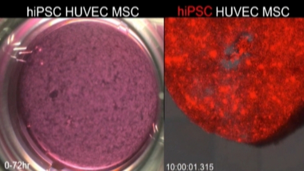 Stem cells were combined with two other cell types required for the development of the human liver
