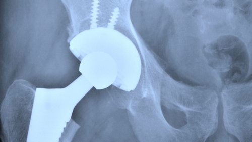 Kernel Capital completes a £2m investment in Cirdan Imaging Limited as part of a £3.5m investment round