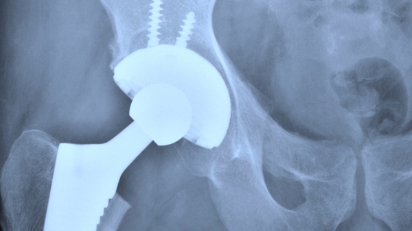 Kernel Capital completes a £2m investment in Cirdan Imaging Limited as part of a £3.5m investment round