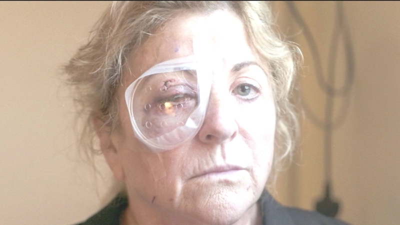 Marie Gauvin was on holidays when she was struck and sustained serious eye injuries