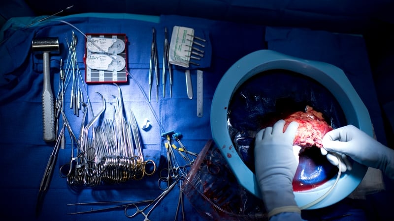 Health Committee Chairman Jerry Buttimer said families could still refuse consent for donation