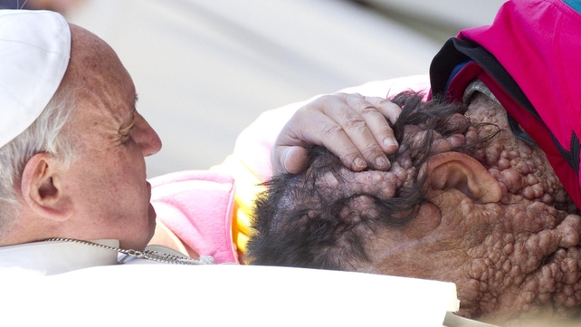 Pope Francis blesses Vinicio Riva during a audience in St Peter's Square