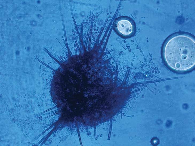 Fungi Chaetomium speceimen isolated from an eye infection in a horse. It has been stained cotton blue with lactophenol so that a microbiologist can clearly see it under the microscope. (Pic: Yvonne Abbott)