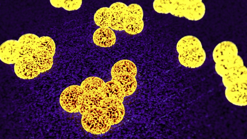 MRSA can be extremely virulent