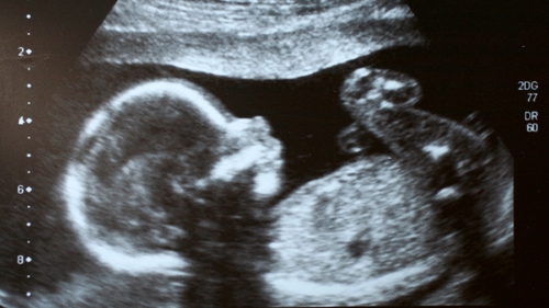 Obstetricians, trainees and midwives will get the new guidelines today