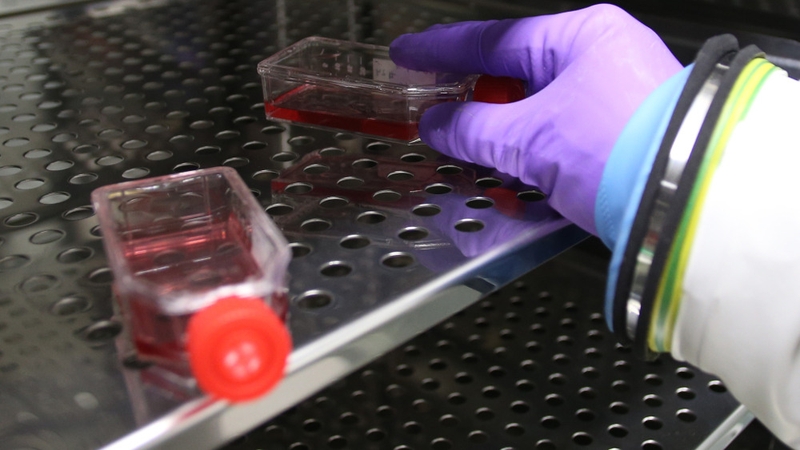 59 people have died from Ebola virus in Guinea