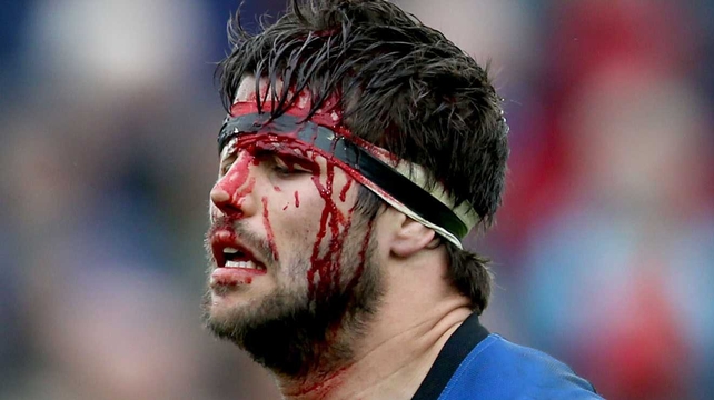 Blood Bath: Guy Mercer had a bit of a headache against Brive in the Amlin Challenge Cup