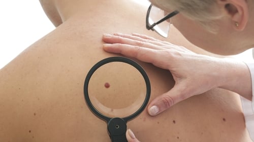 Minister James Reilly said 80% of sun damage to the skin happens before the age of 20