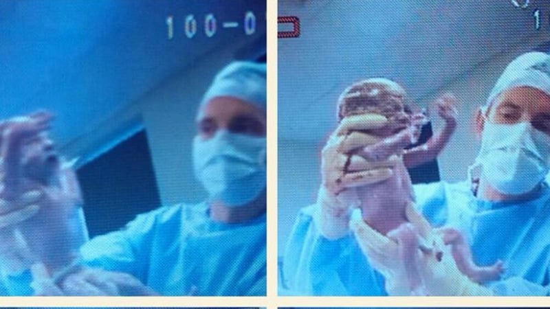 The quadruplets were born within one minute apart