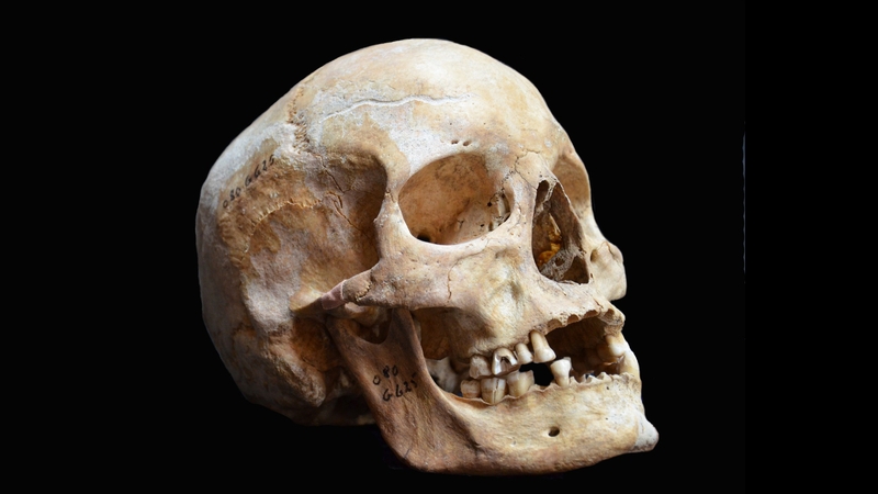 Skulls are said to be 'in demand abroad by people who practice santeria'