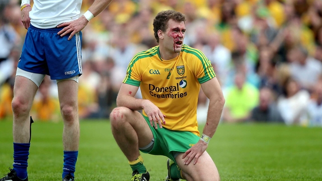 Donegal's Eamon McGee injured in the Ulster SFC final on Sunday