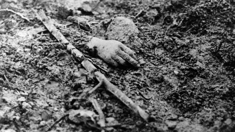 A victim's hand on a battlefield in the north of France. The war cost the life of 1,357,000 French soldiers and 1,773,700 German soldiers
