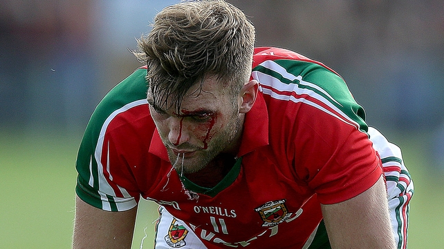 Aidan O'Shea took a nasty knock to the head from team-mate Cillian O'Connor