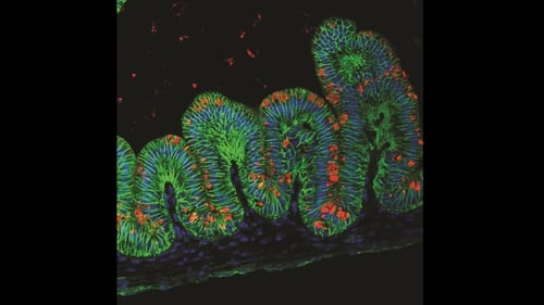 The 3mm-wide hollow "organoids" are lined with various kinds of cells mimicking those of a real stomach