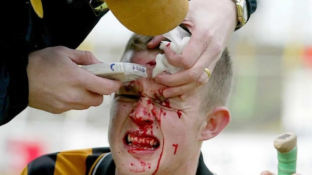 Receiving stitches to a head wound during a league match against Galway in 2003