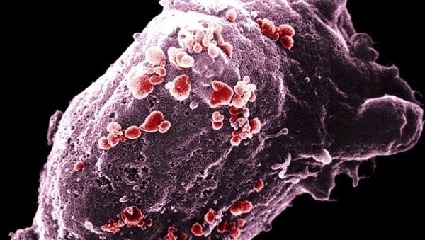 HIQA draft report estimates 173 HIV infections could be averted over the course of the first five years of a PrEP programme