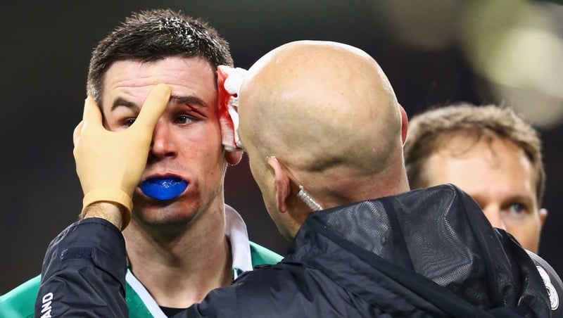 Johnny Sexton receives treatment to the large gash he sustained following a collision with Mathieu Bastareaud