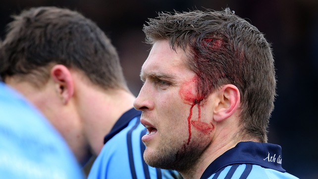 Conal Keaney of Dublin with a head injury after the game against Kilkenny...