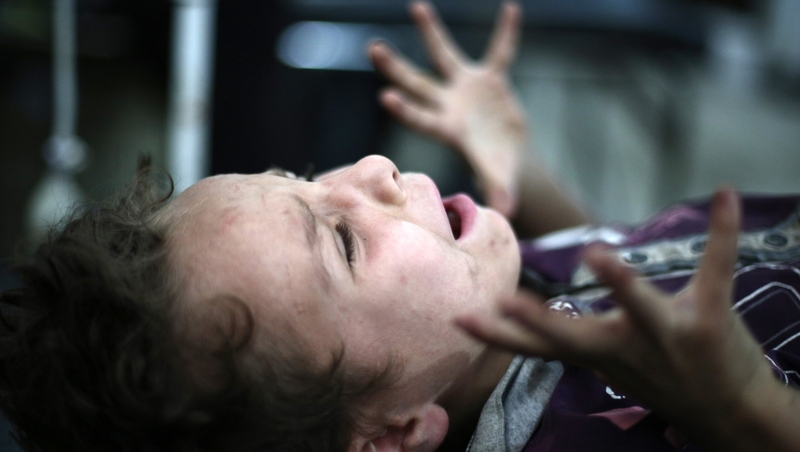 A boy screams as a doctor removes shrapnel from his leg in the rebel-held town of Douma, northeast of the Syrian capital Damascus 3 July 2014