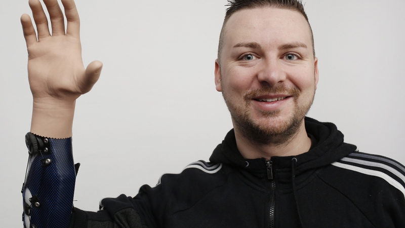 The men had a nine-month period of cognitive training to activate certain muscles and to learn to use electrical signals