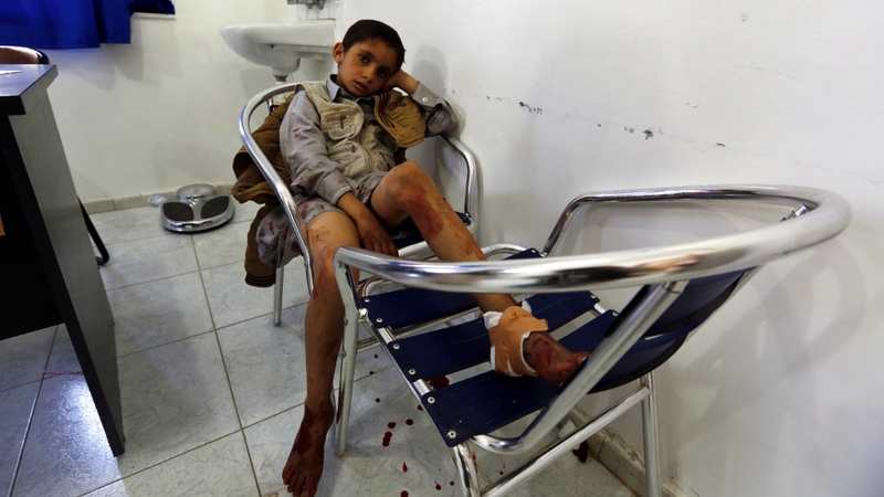 Íospartach óg i measc na gcéadta a gortaíodh sa phléascadh.