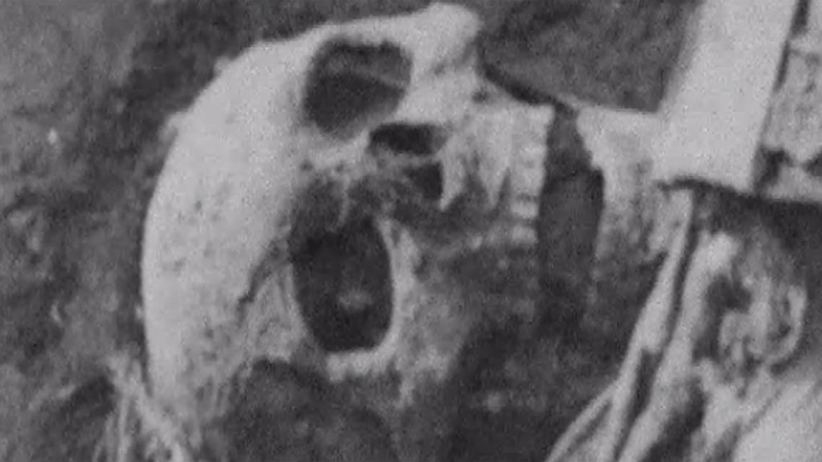 Casualties of WW1