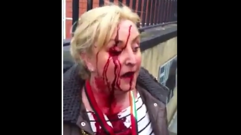 Videos posted online show the injuries suffered by the protester