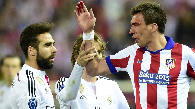 Mario Mandzukic was in the wars in the first leg against Real Madrid