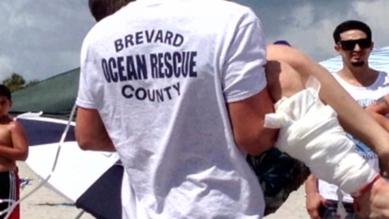 Teenage girl's arm was torn off and also had serious injuries to her leg