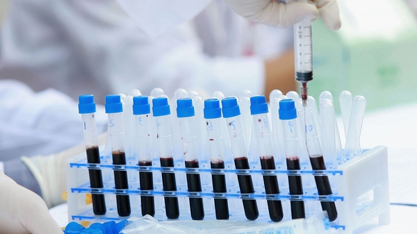 There were 498 new cases of the virus last year