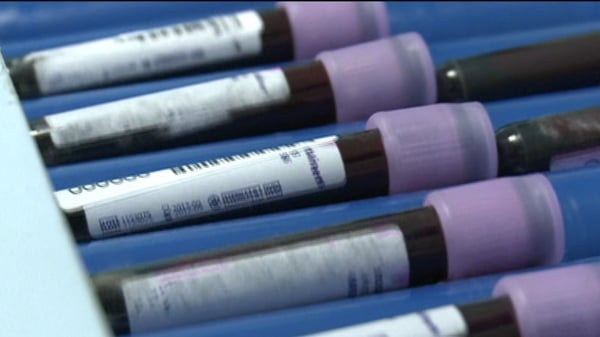Scientists developed a simple screening method involving a biomarker made up of four proteins seen together