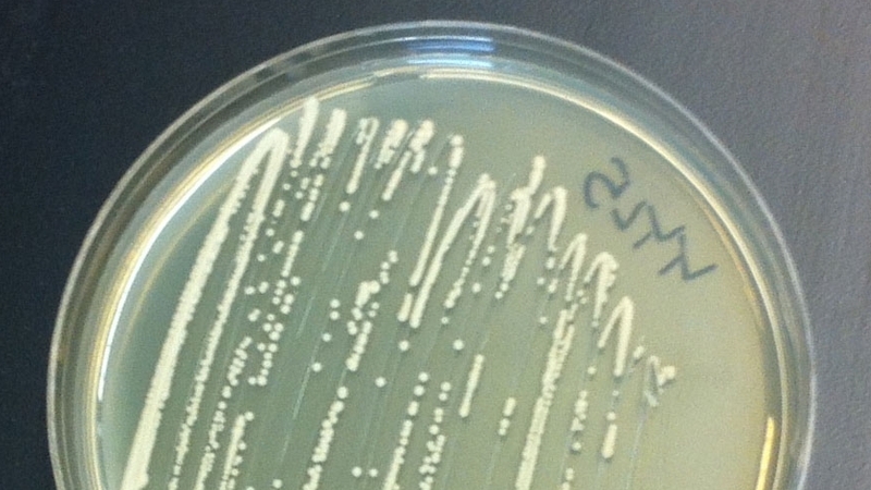 Yeast growing in a petri dish (Pic: Stephanie Galanie)