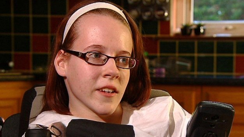 Joanne is one of seven people in the world living with a rare medical disability known as Total Amelia