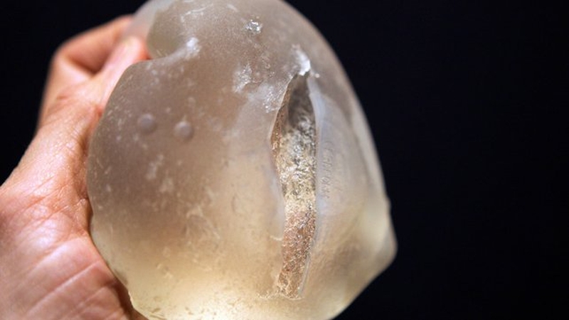 The HPRA says to date there is no indication of any health risk for those who have received the affected implants