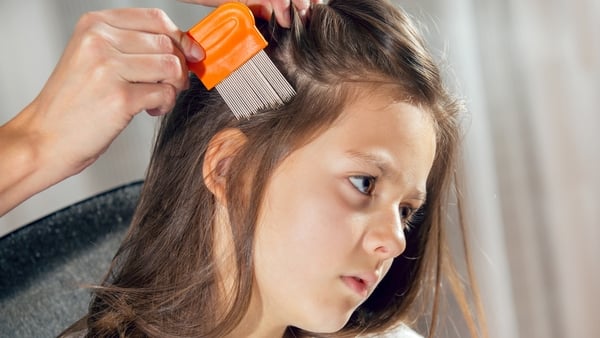Nits - everything you need (but not necessary want!) to know