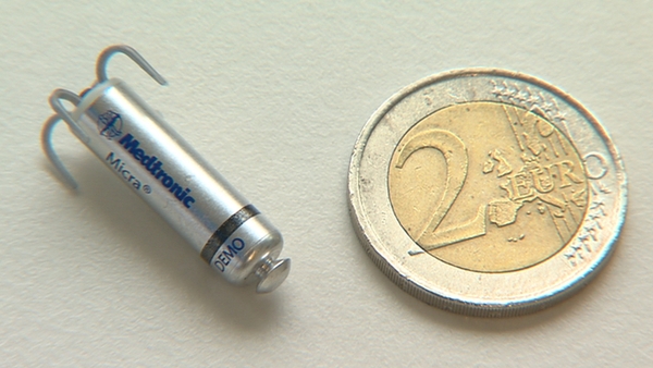 Dublin man fitted with world's smallest pacemaker