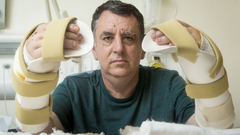 Chris King with his new hands at Leeds General Infirmary