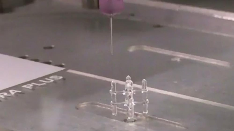 2.2m people globally need a bone graft each year