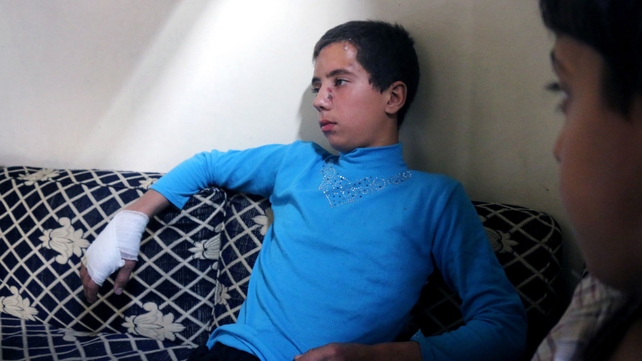 Syrian Jameel Mustafa Habbush, 13, who was rescued a day earlier from under the rubble of a building following Russian air strikes, looks on as he sits at his grandfather's house in the Fardous neighbourhood