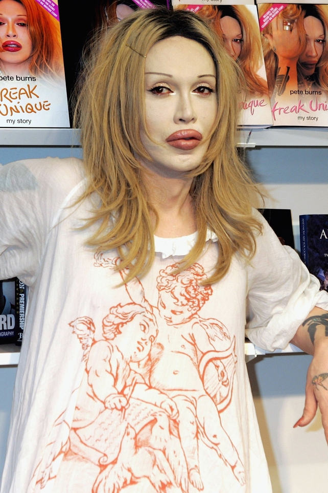 Pete Burns (57), singer, died October 23, 2016