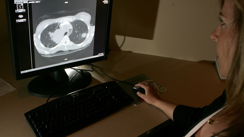 Radiographers are among those who are set to be balloted by SIPTU