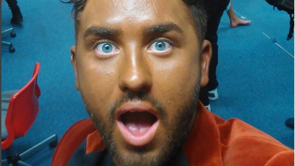 Hughie's fake tan fail...we've all been there pet