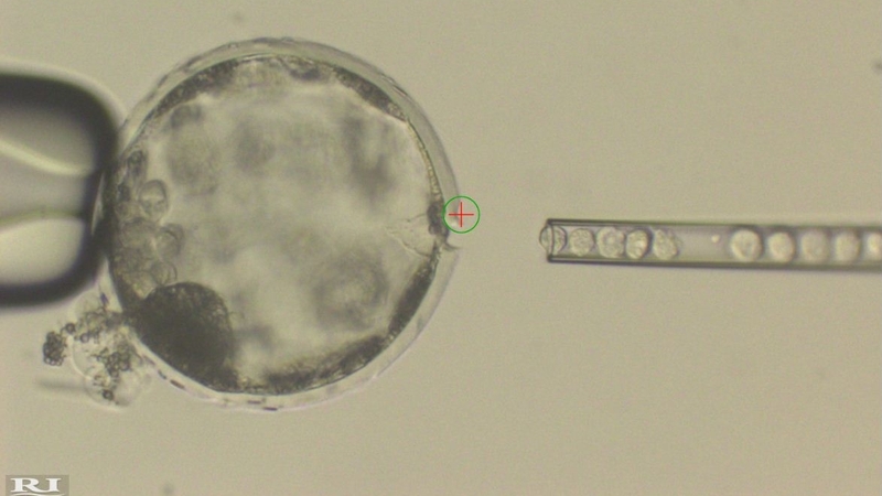 Injection of human iPS cells into a pig blastocyst