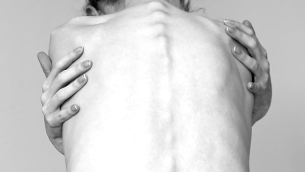 Those suffering from eating disorders become fixated on weight loss